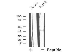 Western blot analysis of extracts from HepG2 cells, using IL13RA2 antibody. (IL13RA2 antibody  (C-Term))