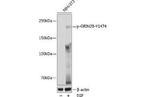 Western blot analysis of extracts of various cell lines, using Phospho-GRIN2B-Y1474 pAb (ABIN6135230, ABIN6136094, ABIN6136095 and ABIN6225667) at 1:1000 dilution.