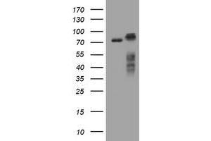 Image no. 1 for anti-Receptor (TNFRSF)-Interacting serine-threonine Kinase 1 (RIPK1) (AA 133-422) antibody (ABIN1490911) (RIPK1 antibody  (AA 133-422))