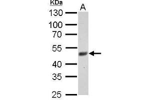 WB Image FBXL3 antibody detects FBXL3 protein by Western blot analysis. (FBXL3 antibody)