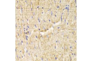 Immunohistochemistry of paraffin-embedded Mouse heart using PDLIM5 antibody at dilution of 1:100 (x400 lens). (PDLIM5 antibody)