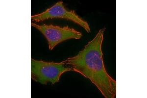 Immunofluorescent analysis of 4 % paraformaldehyde-fixed, 0. (PLEC antibody  (AA 4241-4275))