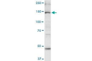 MYO6 monoclonal antibody (M02), clone 2E12. (Myosin VI antibody  (AA 1188-1285))