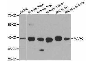 Western blot analysis of extracts of various cell lines, using MAPK1 antibody. (ERK2 antibody  (AA 200-300))