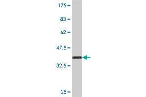 Western Blot detection against Immunogen (37. (CTNS antibody  (AA 1-100))