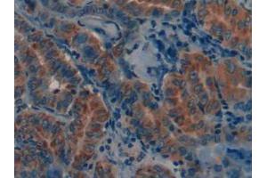 Figure. (MMP12 antibody  (AA 290-469))