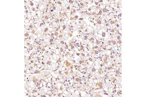 Immunohistochemistry analysis of paraffin-embedded mouse placentausing ALG6 (ABIN7073127) at dilution of 1:1200 (ALG6 antibody)