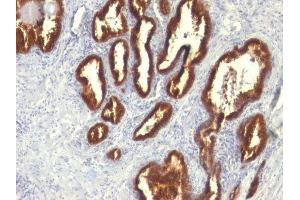 Image no. 1 for anti-Keratin 18 (KRT18) antibody (ABIN6179389) (Cytokeratin 18 antibody)