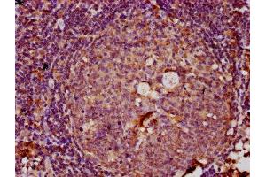 IHC image of ABIN7151049 diluted at 1:100 and staining in paraffin-embedded human tonsil tissue performed on a Leica BondTM system. (RNF160 antibody  (AA 462-591))
