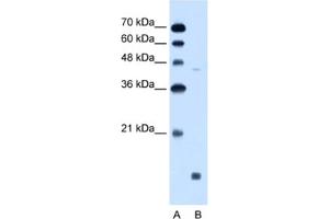 Western Blotting (WB) image for anti-Sphingosine-1-Phosphate Receptor 5 (S1PR5) antibody (ABIN2462616)