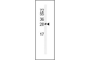 ICOS- (ABIN390089 and ABIN2840606) western blot analysis in Jurkat cell line lysates (35 μg/lane). (ICOS antibody  (C-Term))