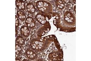 Immunohistochemical staining of human colon with LCMT2 polyclonal antibody  shows strong cytoplasmic positivity in glandular cells at 1:50-1:200 dilution. (LCMT2 antibody)