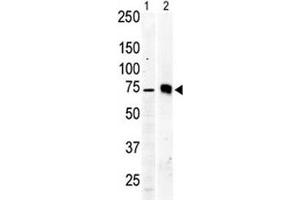Western blot testing of PKC beta 2 antibody and Jurkat cell lysate (lane 1) and mouse brain tissue lysate (2). (PKC beta antibody  (AA 642-673))