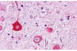 Image no. 1 for anti-G Protein-Coupled Receptor 151 (GPR151) (Cytoplasmic Domain) antibody (ABIN1048737) (GPR151 antibody  (Cytoplasmic Domain))