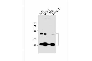 All lanes : Anti-CTSD Antibody at 1:1000 dilution Lane 1: A431 whole cell lysate Lane 2: MCF-7 whole cell lysate Lane 3: K562 whole cell lysate Lane 4: NC-1 whole cell lysate Lysates/proteins at 20 μg per lane. (Cathepsin D antibody  (AA 1-412))