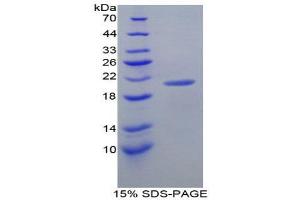 SDS-PAGE (SDS) image for Amiloride Binding Protein 1 (Amine Oxidase (Copper-Containing)) (ABP1) (AA 292-460) protein (His tag) (ABIN1170321) (DAO Protein (AA 292-460) (His tag))