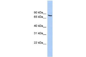 WB Suggested Anti-ACCN4 Antibody Titration: 0. (ACCN4 antibody  (Middle Region))