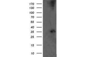 Western Blotting (WB) image for anti-T-cell surface glycoprotein CD1c (CD1C) antibody (ABIN2670667) (CD1c antibody)