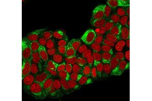 Immunofluorescence (IF) image for anti-Trefoil Factor 1 (TFF1) antibody (ABIN6940690)