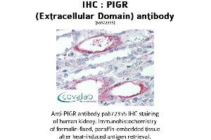 Image no. 1 for anti-Polymeric Immunoglobulin Receptor (PIGR) (Extracellular Domain) antibody (ABIN1738097) (PIGR antibody  (Extracellular Domain))