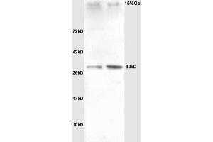 Lane 1: rat heart Lane 2: rat liver lysates probed with Anti SNAI2/SLUG Polyclonal Antibody, Unconjugated (ABIN685747) at 1:200 in 4 °C. (SLUG antibody  (AA 5-120))