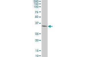 DKK1 monoclonal antibody (M01), clone 4D4. (DKK1 antibody  (AA 81-180))