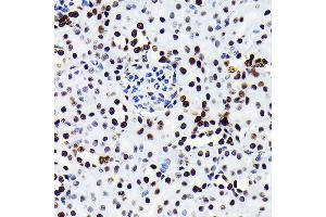 Immunohistochemistry of paraffin-embedded Mouse kidney using HMGB1 antibody (ABIN7267648) at dilution of 1:100 (40x lens). (HMGB1 antibody)