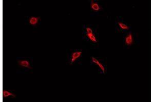 ABIN6269213 staining A549 cells by IF/ICC. (CDC25B antibody  (Internal Region))