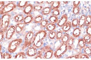 Immunohistochemistry (Paraffin-embedded Sections) (IHC (p)) image for anti-serine Hydroxymethyltransferase 1 (Soluble) (SHMT1) antibody (ABIN7256154)