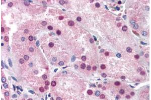 Human Kidney (formalin-fixed, paraffin-embedded) stained with NR1I3 antibody ABIN337348 at 10-20 ug/ml followed by biotinylated goat anti-rabbit IgG secondary antibody ABIN481713, alkaline phosphatase-streptavidin and chromogen. (NR1I3 antibody  (N-Term))