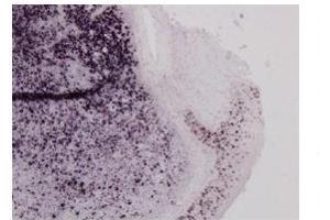 Sample Type:  Human Tonsil TissuePrimary   Dilution:  1ug/mL (MSH6 antibody  (N-Term))