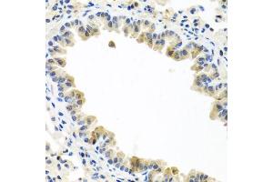 Immunohistochemistry (Paraffin-embedded Sections) (IHC (p)) image for anti-Bone Morphogenetic Protein 5 (BMP5) (AA 317-454) antibody (ABIN6137604)