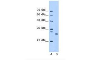 Image no. 1 for anti-PSMC3 Interacting Protein (PSMC3IP) (AA 143-192) antibody (ABIN321308) (PSMC3IP antibody  (AA 143-192))