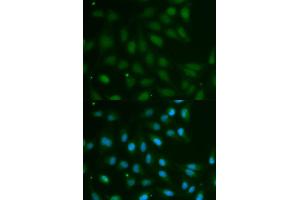 Immunofluorescence analysis of MCF-7 cells using ABO antibody (ABIN5970766). (ABO antibody)