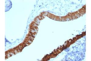 Formalin-fixed, paraffin-embedded human Ovary stained with Cytokeratin 3 Mouse Monoclonal Antibody (KRT3/2130). (Keratin 3 antibody)
