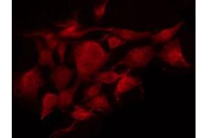 Immunofluorescence (fixed cells) (IF/ICC) image for anti-Siah E3 Ubiquitin Protein Ligase 2 (SIAH2) (C-Term) antibody (ABIN6265080)