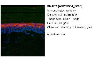 Image no. 2 for anti-SMAD, Mothers Against DPP Homolog 2 (SMAD2) (N-Term) antibody (ABIN2779412) (SMAD2 antibody  (N-Term))