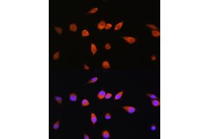 Immunofluorescence analysis of L929 cells using R Rabbit pAb (ABIN7269800) at dilution of 1:100. (RAB20 antibody  (AA 80-190))