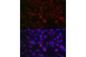 Immunofluorescence analysis of HeLa cells using AURKA Rabbit pAb (ABIN3022969, ABIN3022970, ABIN3022971 and ABIN6219323) at dilution of 1:100 (40x lens). (Aurora A antibody  (AA 1-100))