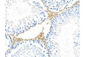 ABIN6259135 and ABIN6275366 at 1/100 staining Rat testis tissue by IHC-P.