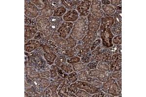 Immunohistochemical staining of human kidney with TRIM7 polyclonal antibody  shows strong cytoplasmic positivity in tubular cells at 1:200-1:500 dilution. (TRIM7 antibody)