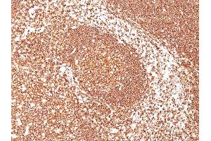 Immunohistochemistry (IHC) image for anti-Protein tyrosine Phosphatase, Receptor Type, C (PTPRC) antibody (ABIN6940448)