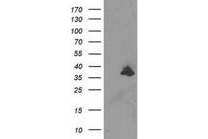 Image no. 1 for anti-Uracil-DNA Glycosylase (UNG) antibody (ABIN1501680) (UNG antibody)