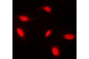Immunofluorescent analysis of ANAPC1 staining in HeLa cells. (APC1 antibody  (Center))
