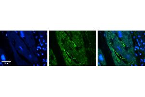 Rabbit Anti-RB1CC1 Antibody   Formalin Fixed Paraffin Embedded Tissue: Human heart Tissue Observed Staining: Peripheral membrane Primary Antibody Concentration: N/A Other Working Concentrations: 1:600 Secondary Antibody: Donkey anti-Rabbit-Cy3 Secondary Antibody Concentration: 1:200 Magnification: 20X Exposure Time: 0. (FIP200 antibody  (C-Term))