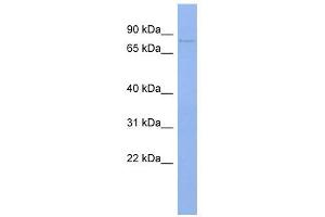 PAPOLB antibody used at 1 ug/ml to detect target protein. (PAPOLB antibody  (N-Term))