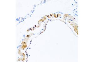 Immunohistochemistry of paraffin-embedded rat lung using PHPT1 antibody (ABIN5970475) at dilution of 1/100 (40x lens). (PHPT1 antibody)