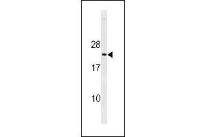 Mouse p27Kip1 Antibody (C-term ) (ABIN1881618 and ABIN2843237) western blot analysis in mouse heart tissue lysates (35 μg/lane). (CDKN1B antibody  (C-Term))