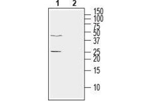 Western blot analysis of human LNCaP prostate adenocarcinoma cell line lysate: - 1. (Ephrin A5 antibody  (Extracellular))