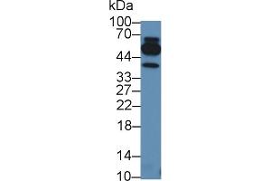Detection of TNFb in Human Leukocyte lysate using Polyclonal Antibody to Tumor Necrosis Factor Beta (TNFb) (LTA antibody  (AA 49-202))